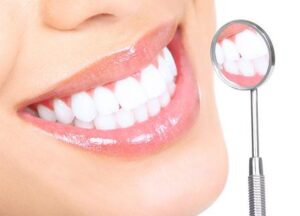 teeth whitening Dubai