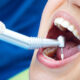 Reasons why you should not be Nervous about Dental Implant Surgery