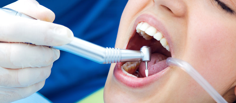 Reasons why you should not be Nervous about Dental Implant Surgery