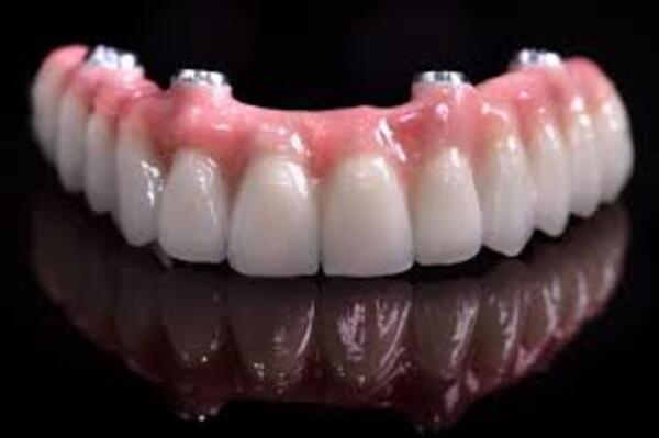 Dental implant procedure for denture wearers in Dubai with Dr. Thomas